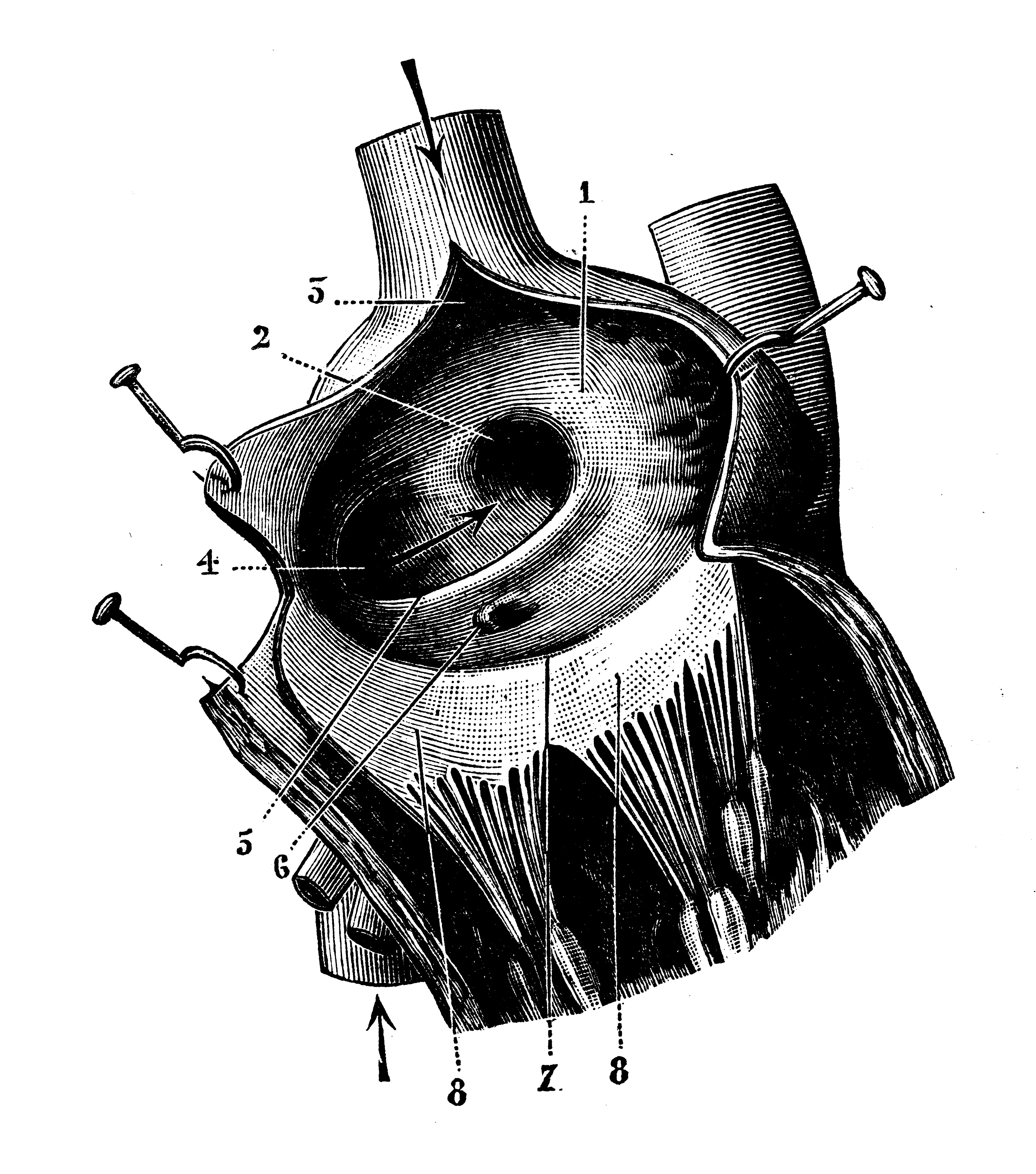 Patent Foramen Ovale Ameliyatı: Ne Zaman Ameliyat Gerekir ?