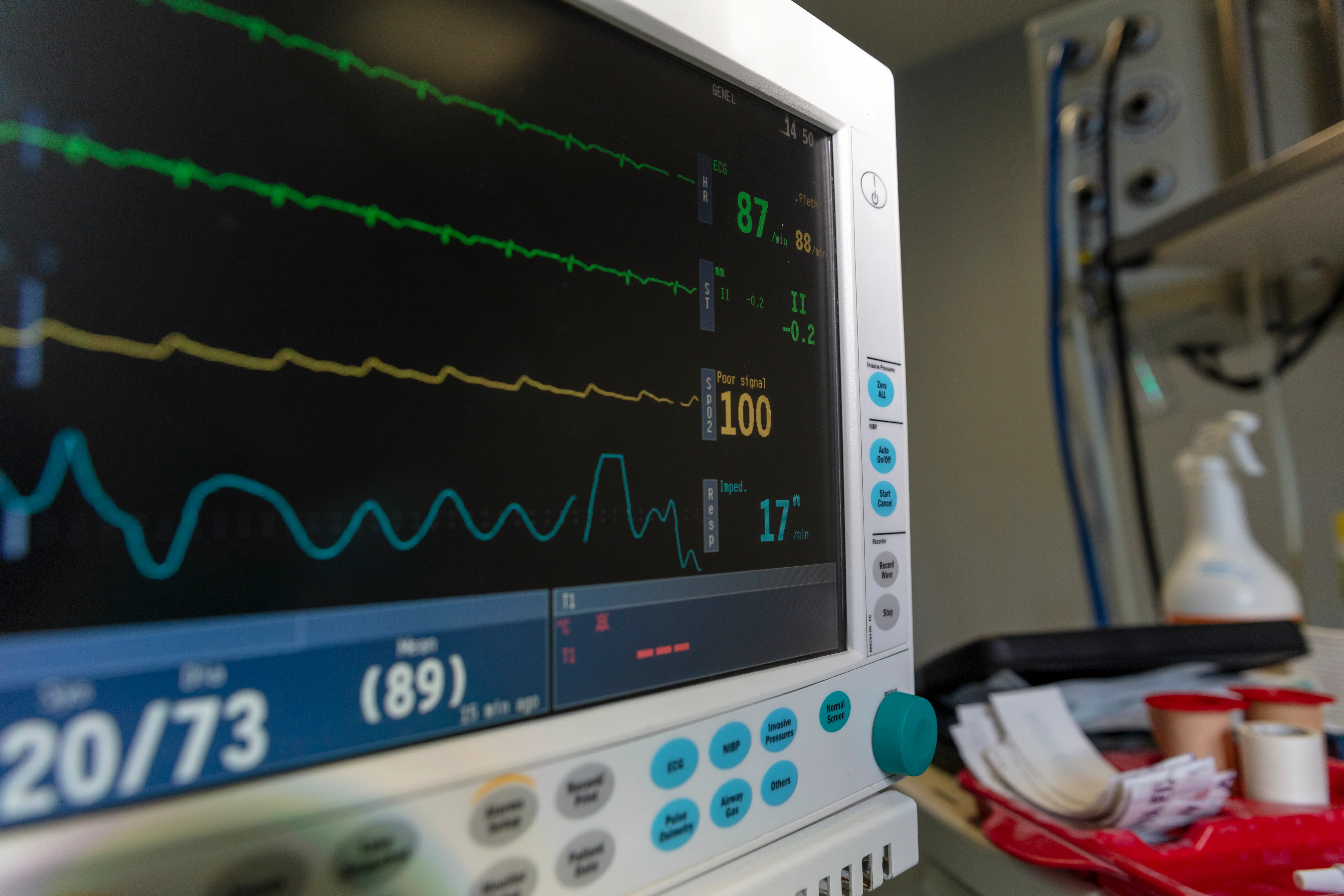 Kalp Kapak Hastalıklarında Erken Teşhisin Önemi