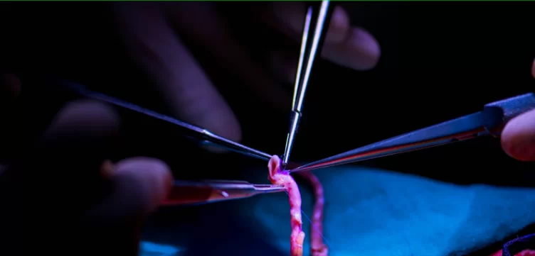 Kapalı Koroner Bypass: Riskler ve Avantajlar