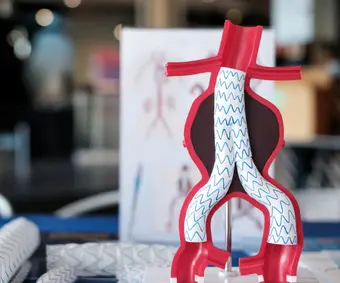 Kapalı Yöntem Aort Ameliyatları